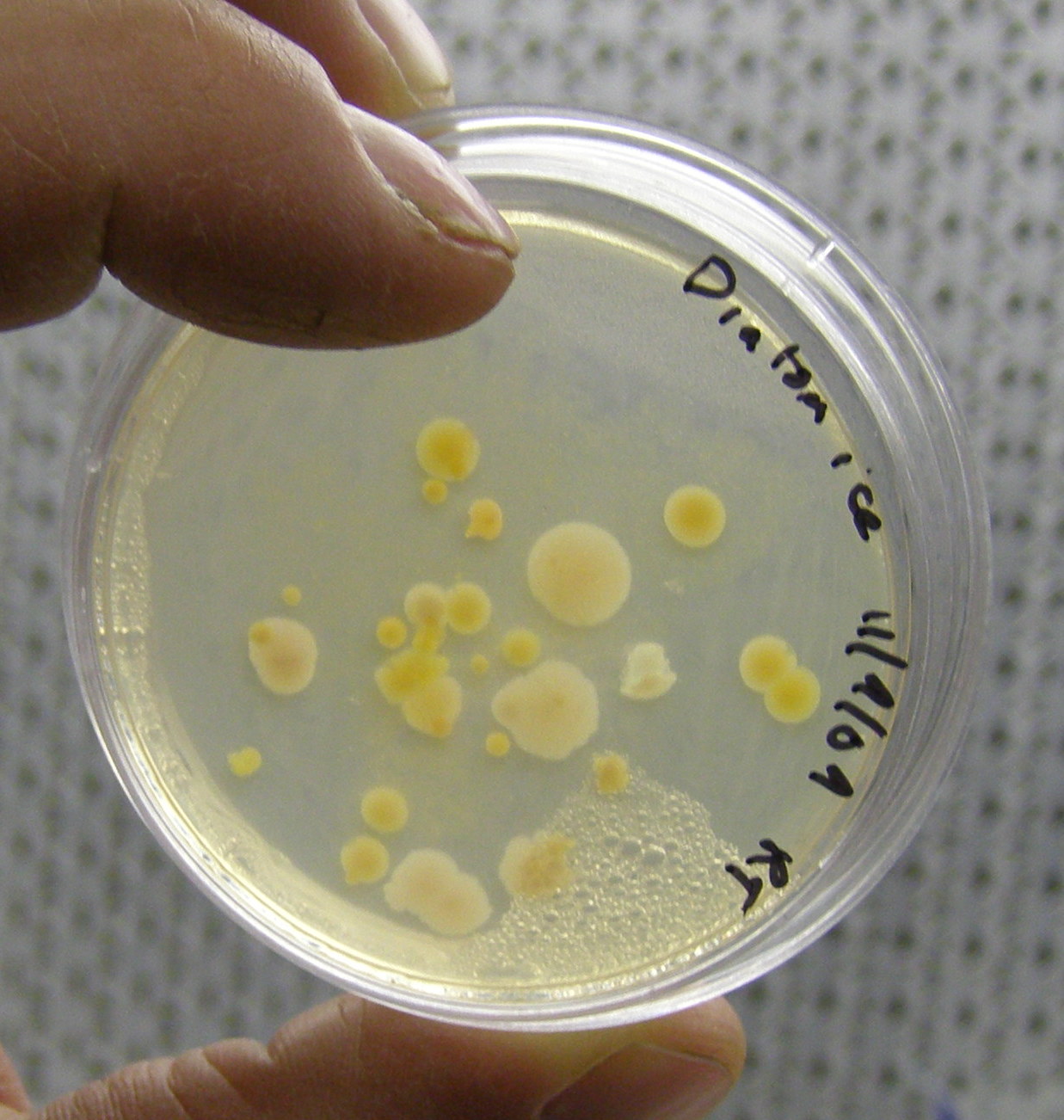 close-up of the Petri dish