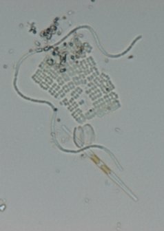 Micrograph of the Albufera sample