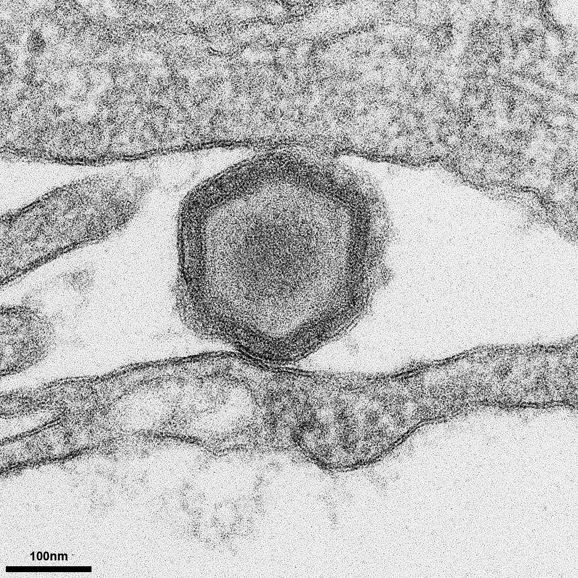 An electron micrograph of an African swine fever virus particle